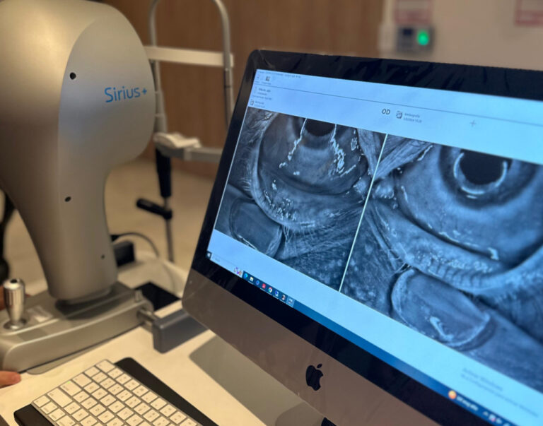 Meibografia para diagnóstico de ojo seco